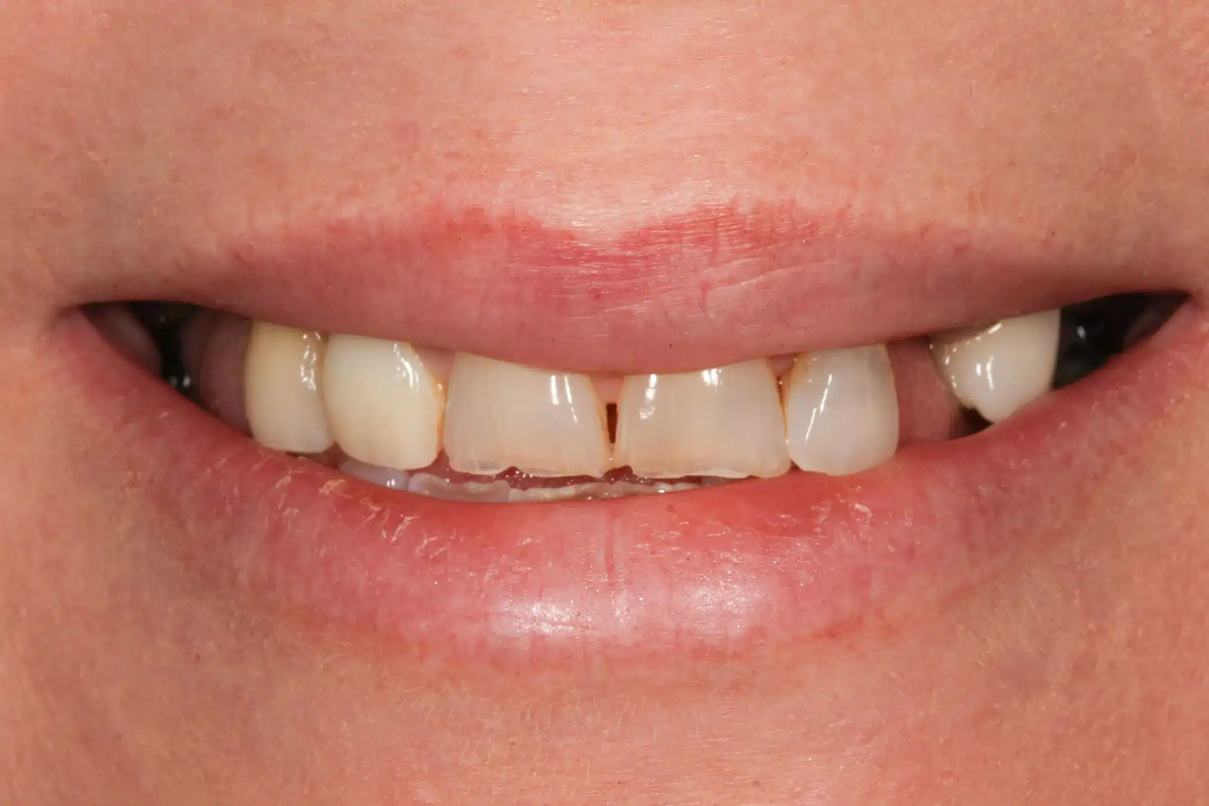 Before image