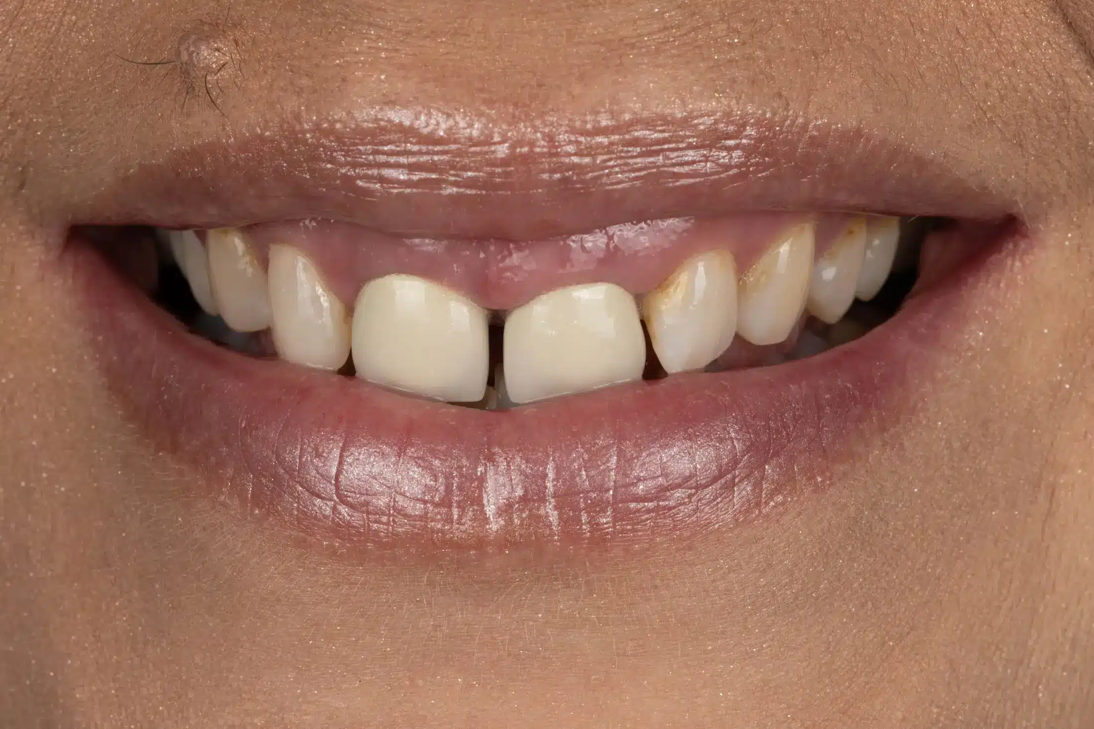 Before image