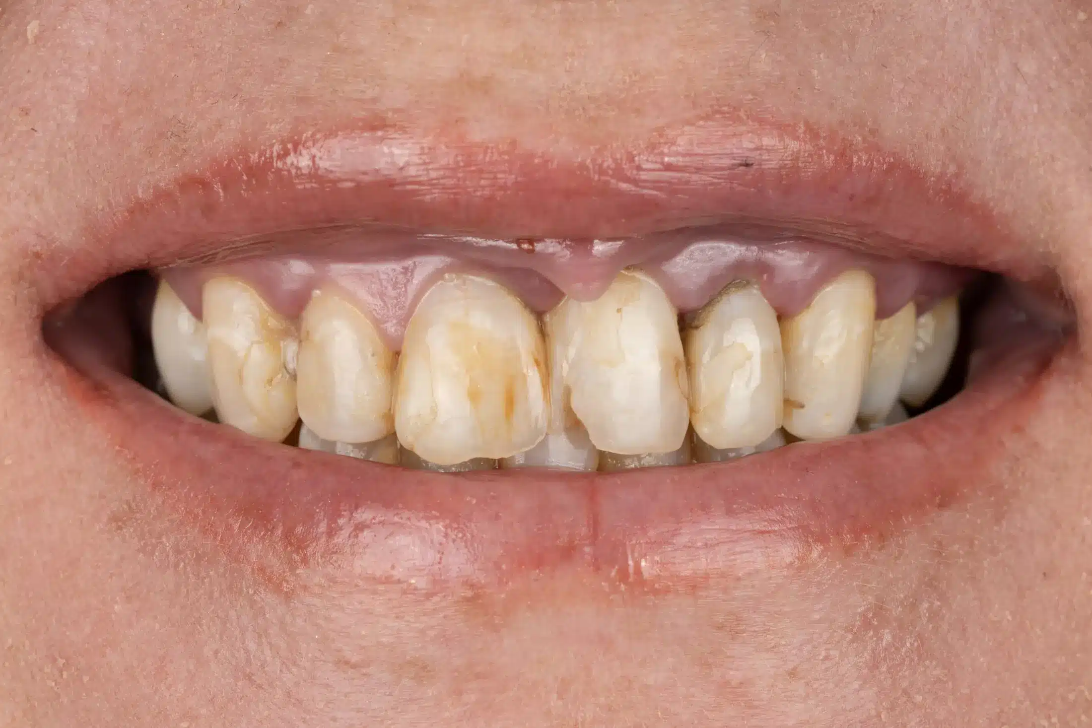 Before image