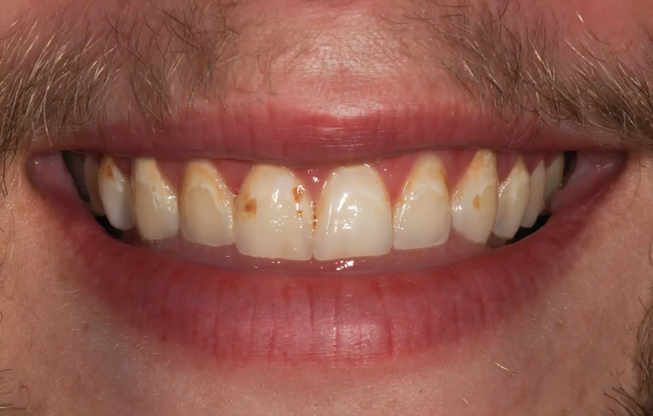 Before image