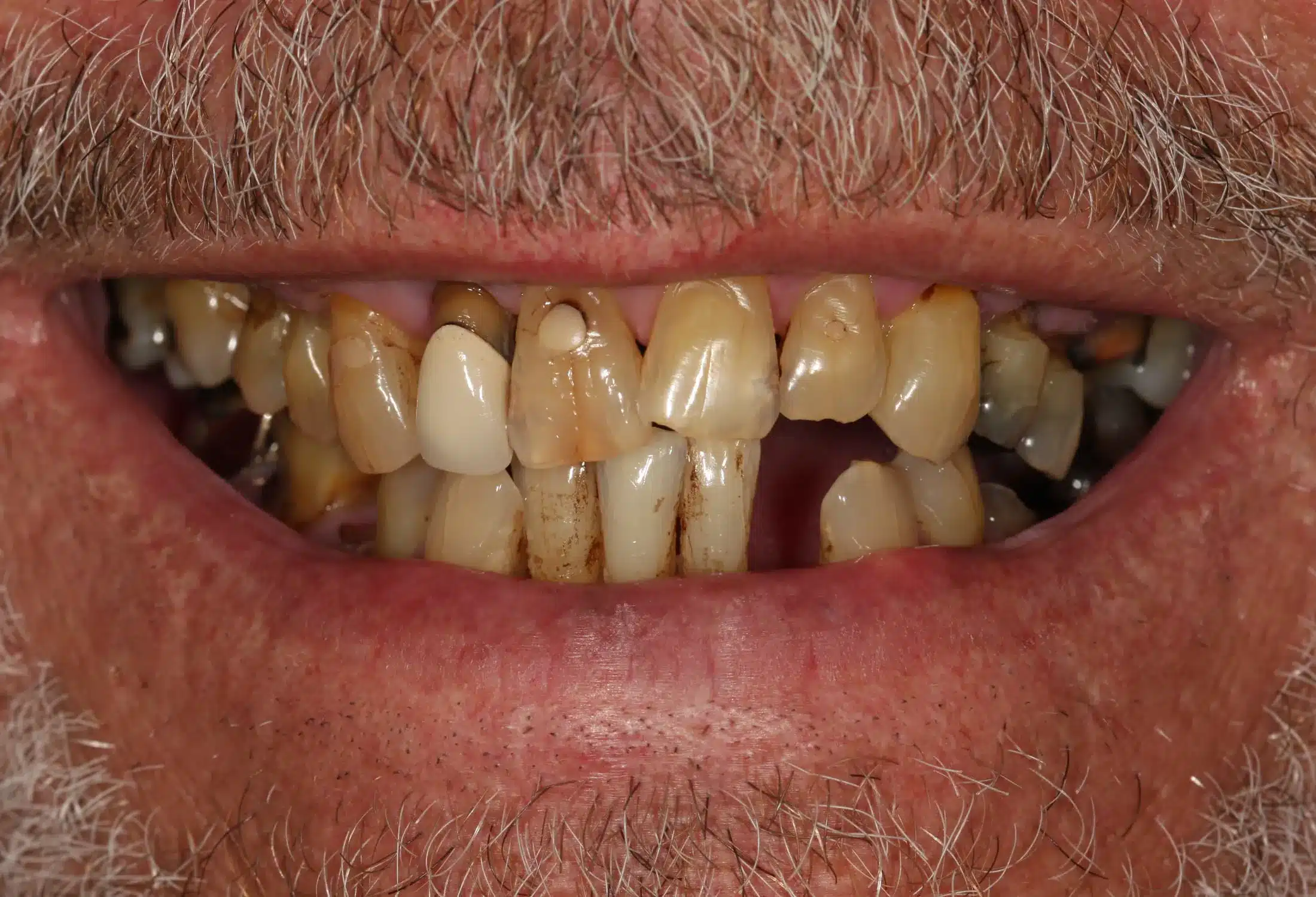 Before image