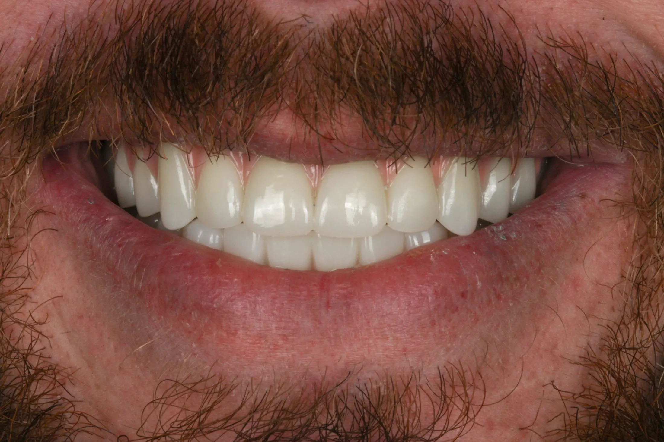 After image