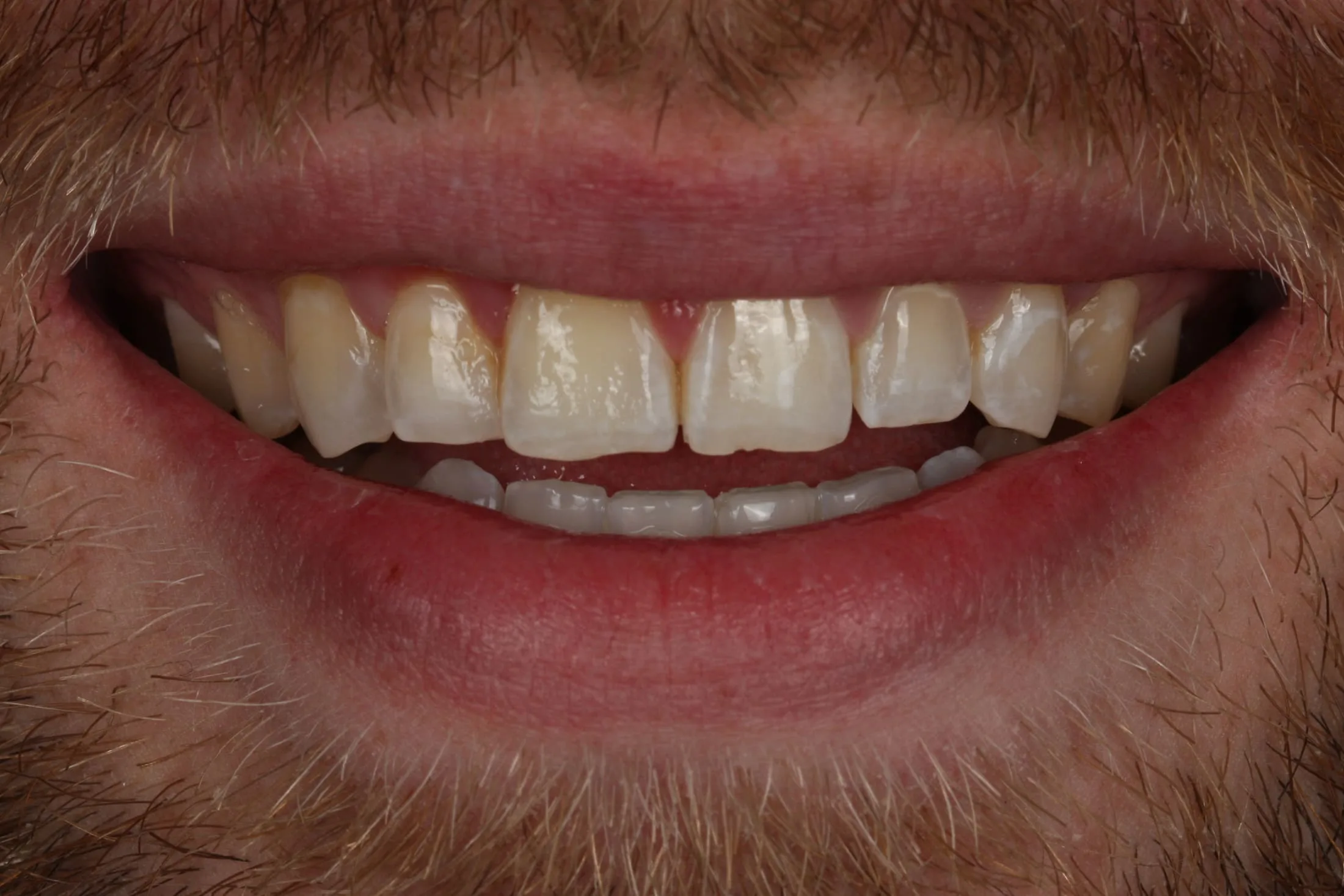 Before image
