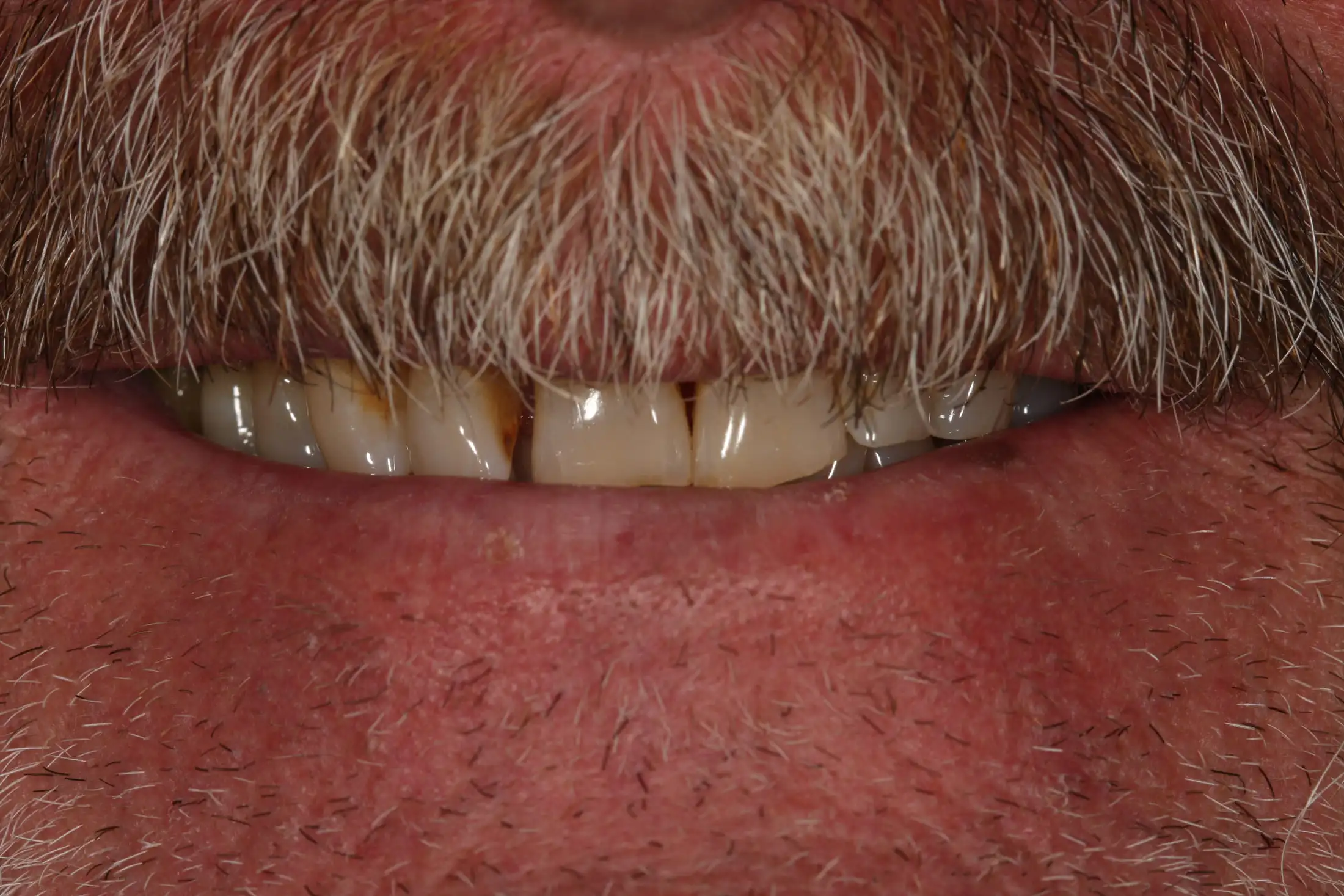 Before image