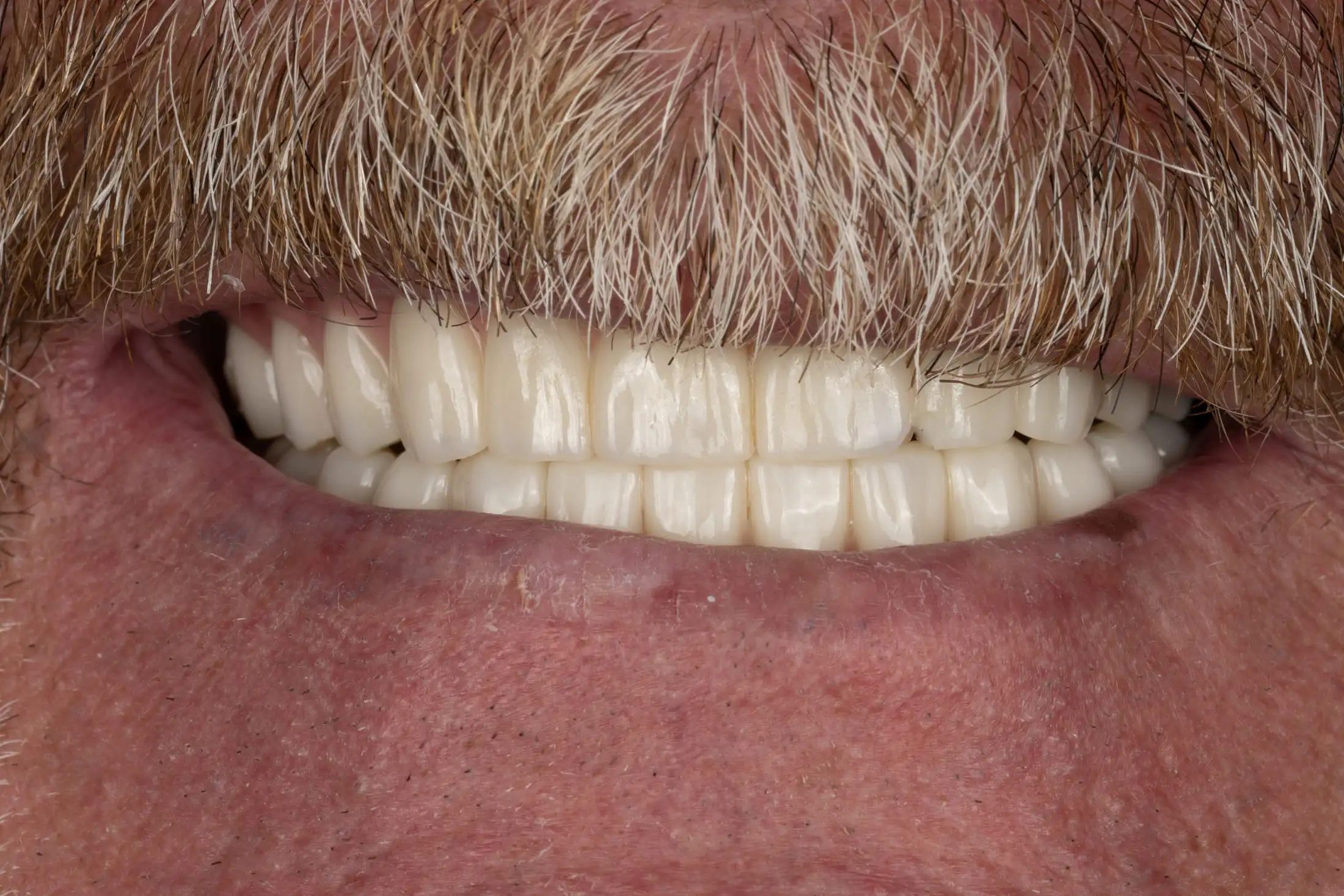 After image