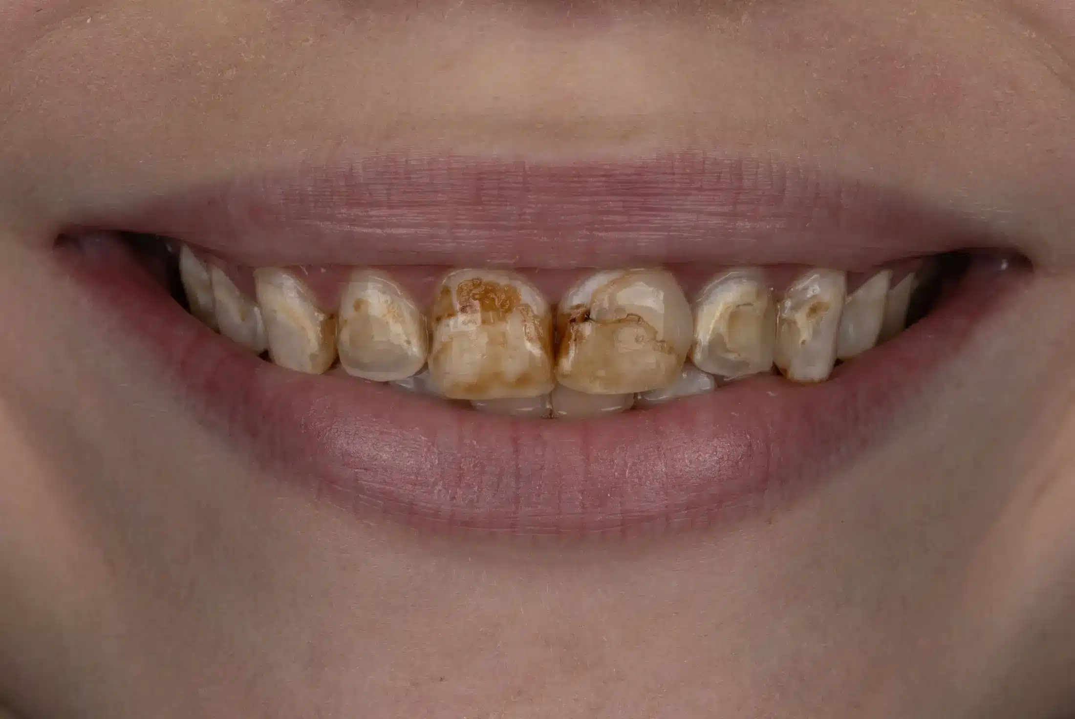 Before image
