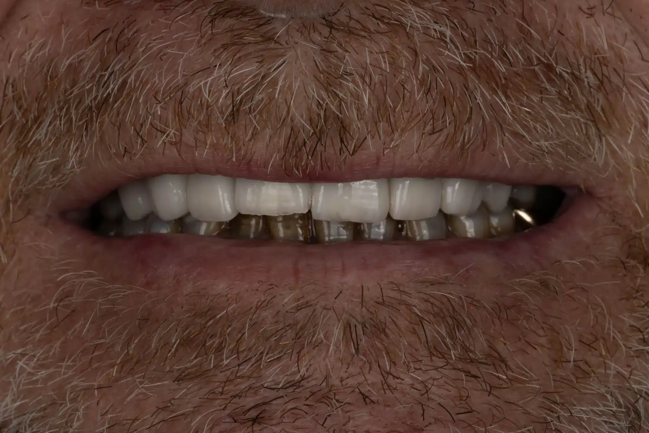 Before image