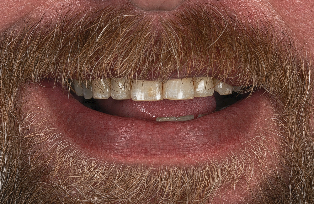 Before image