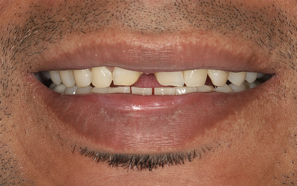 Before image