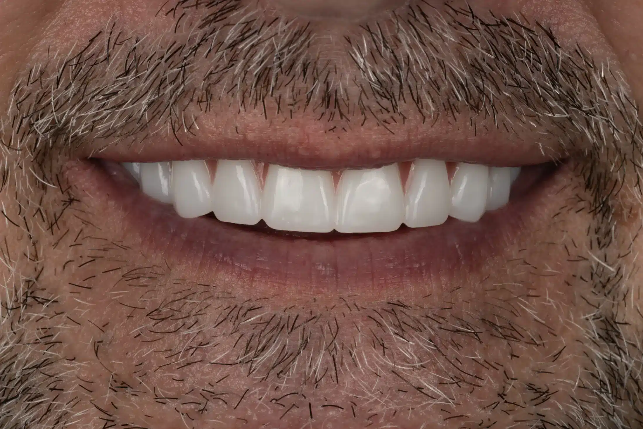 After image