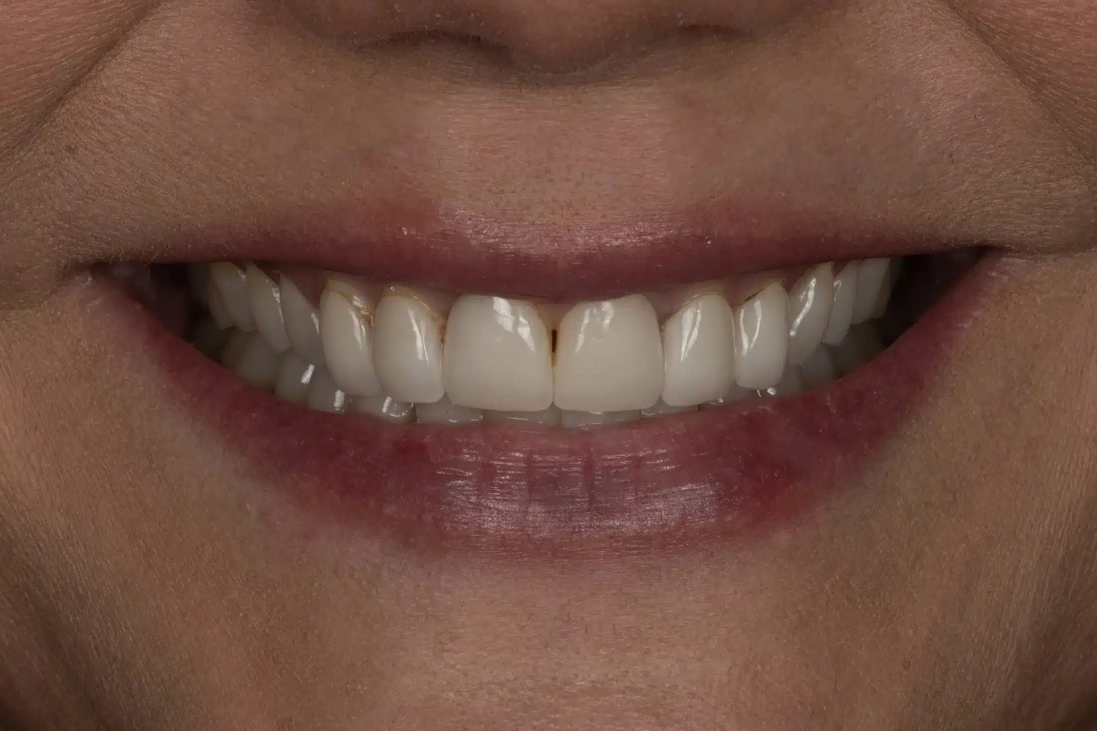 Before image