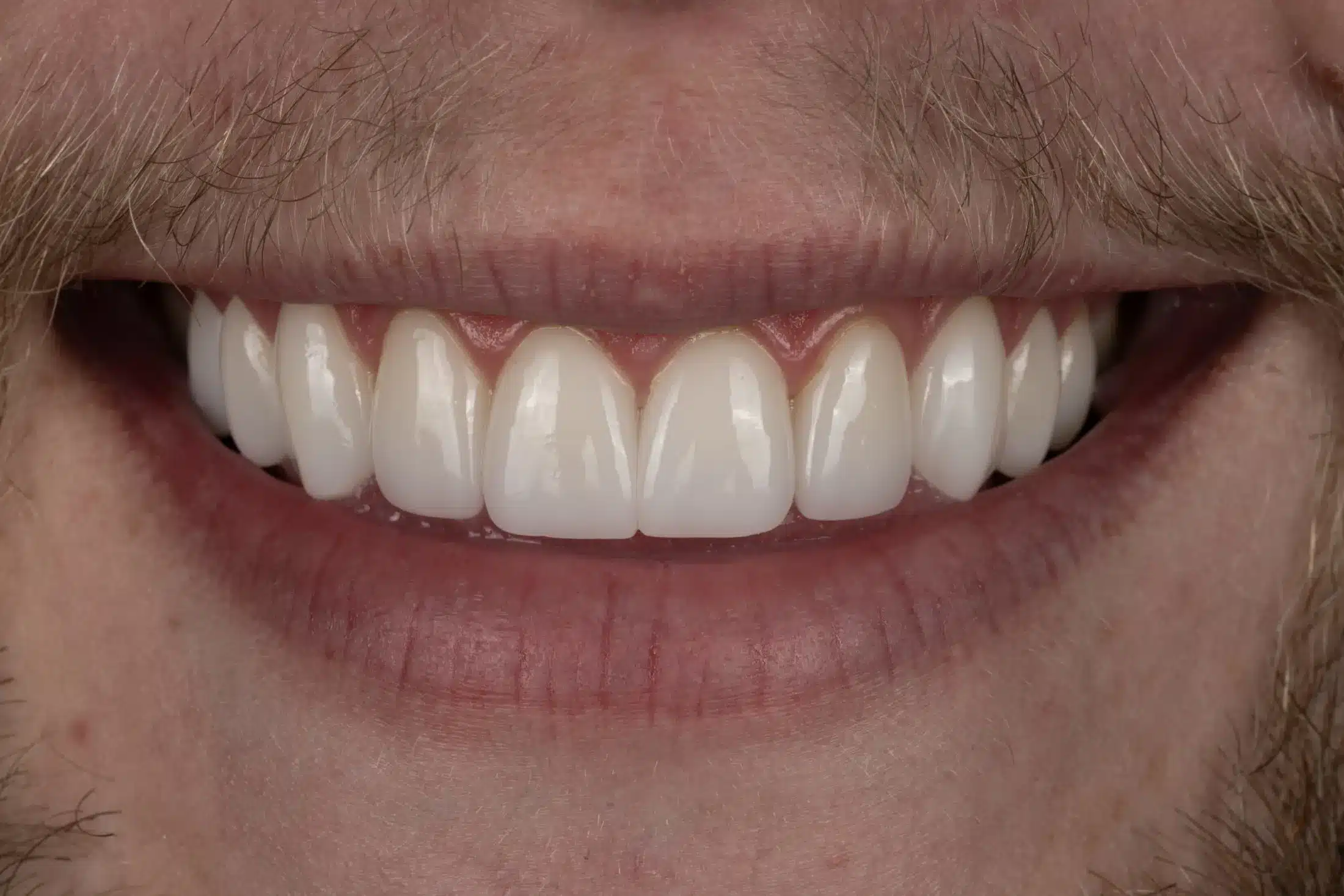 After image