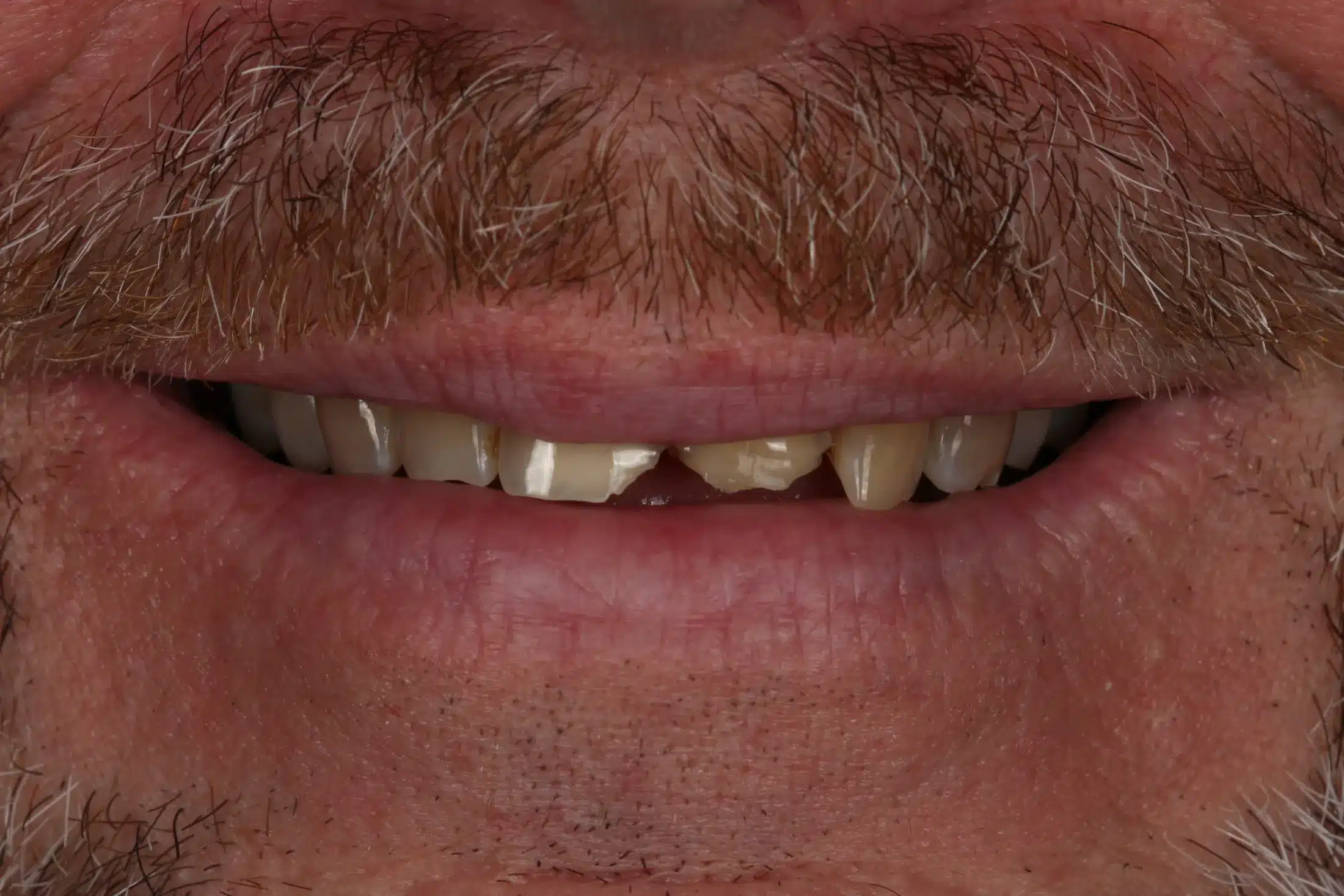 Before image