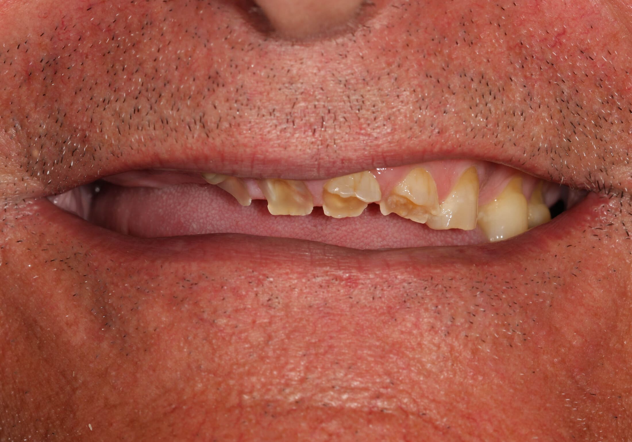 Before image